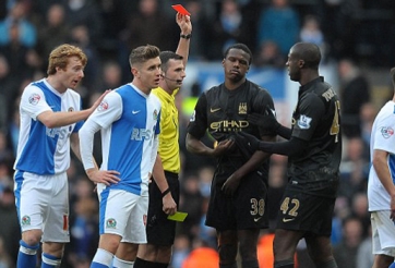 Bị đuổi người, Man City hòa thất vọng trước Blackburn